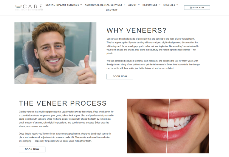 Veneers in Boise: Transform Your Smile with Dr. Drew Phillips at Care Dental Implant & Cosmetic Center
